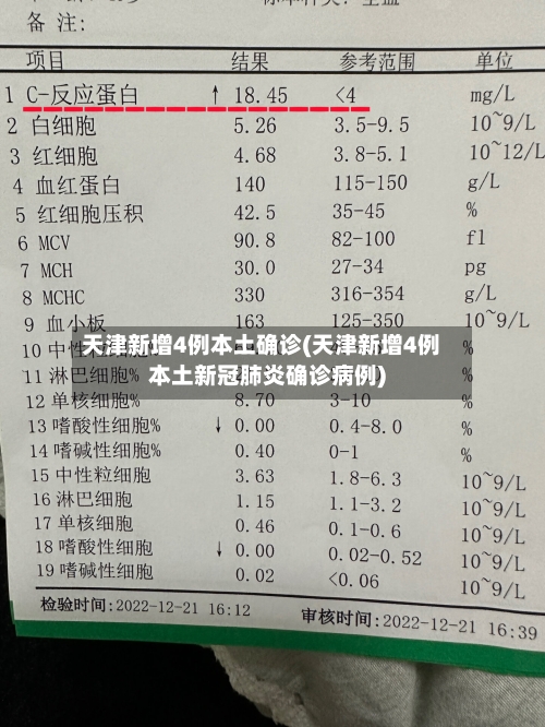 天津新增4例本土确诊(天津新增4例本土新冠肺炎确诊病例)